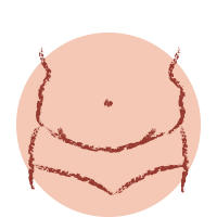 Icon Inchaço Abdominal 