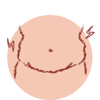 Icon Cólicas Menstruais