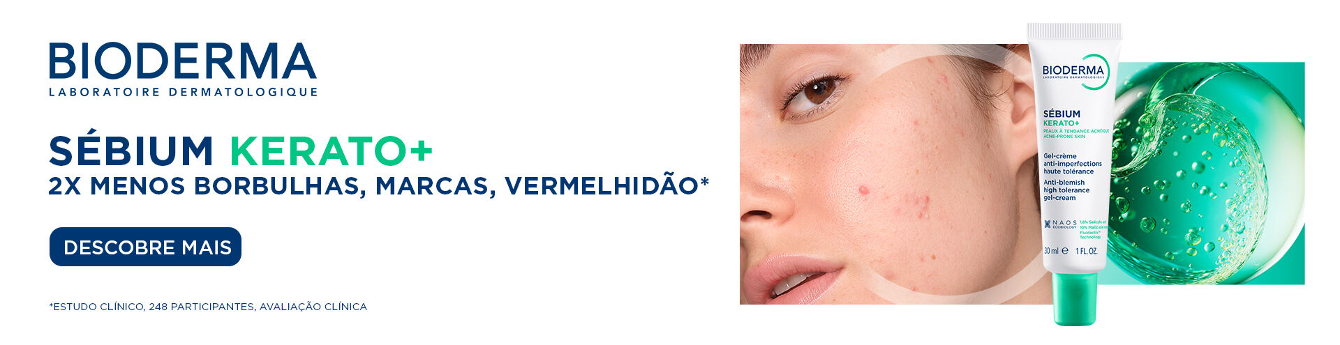 Bioderma S&eacute;bium Kerato+. 2x menos borbulhas, marcas e vermelhid&atilde;o*. Descobre mais. Estudo cl&iacute;nico, 248 participantes, avalia&ccedil;&atilde;o cl&iacute;nica. Descobre j&aacute;!