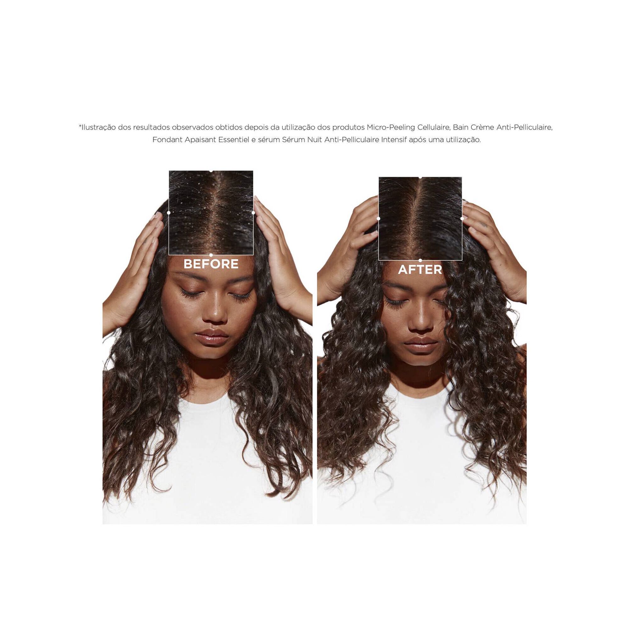 Symbiose Bain Crème Anti-Pelliculaire