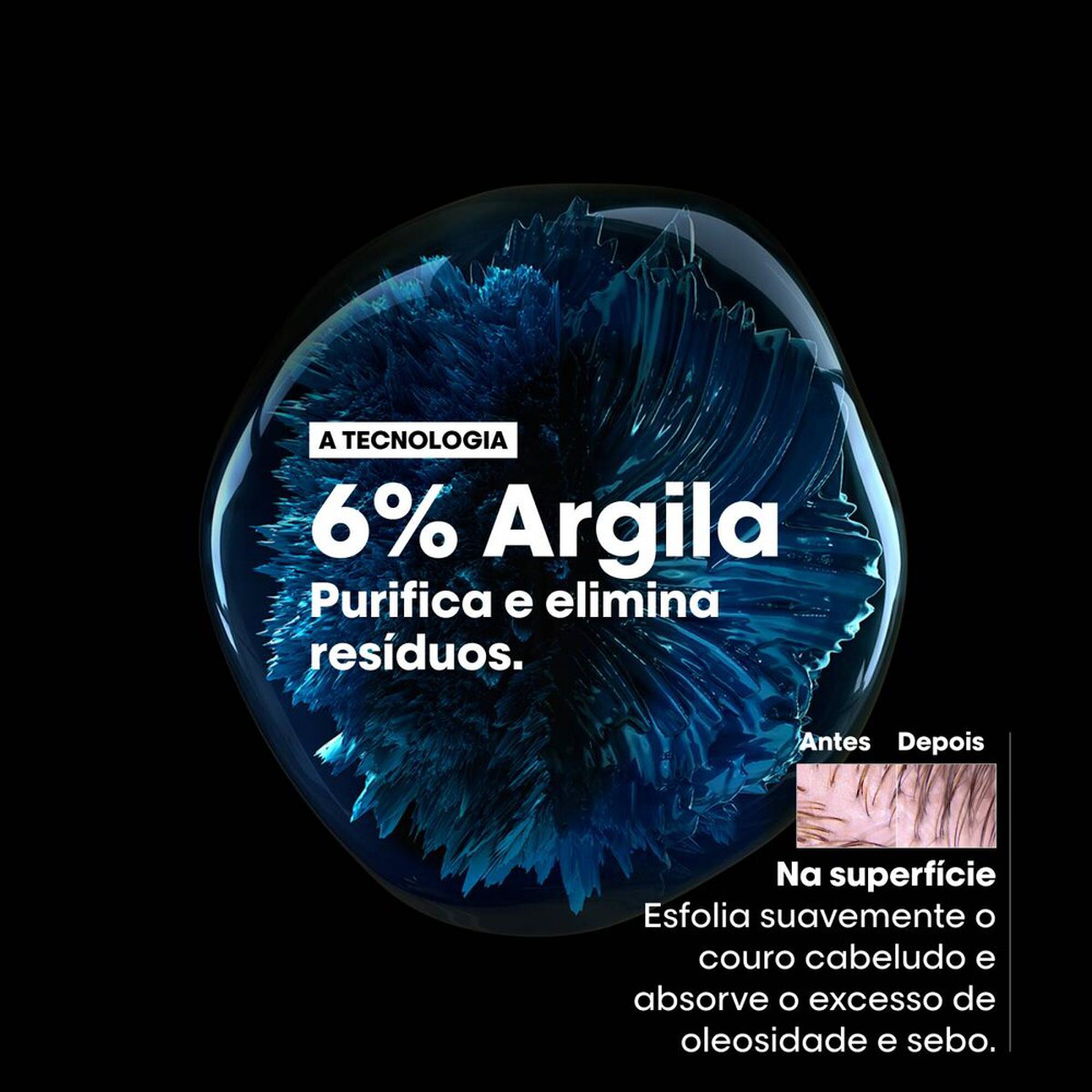 Serie Expert Scalp Advanced Anti-Gras Argile