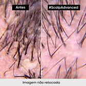 Serie Expert Scalp Advanced Pelliculaire Shampoo Wells Image 18