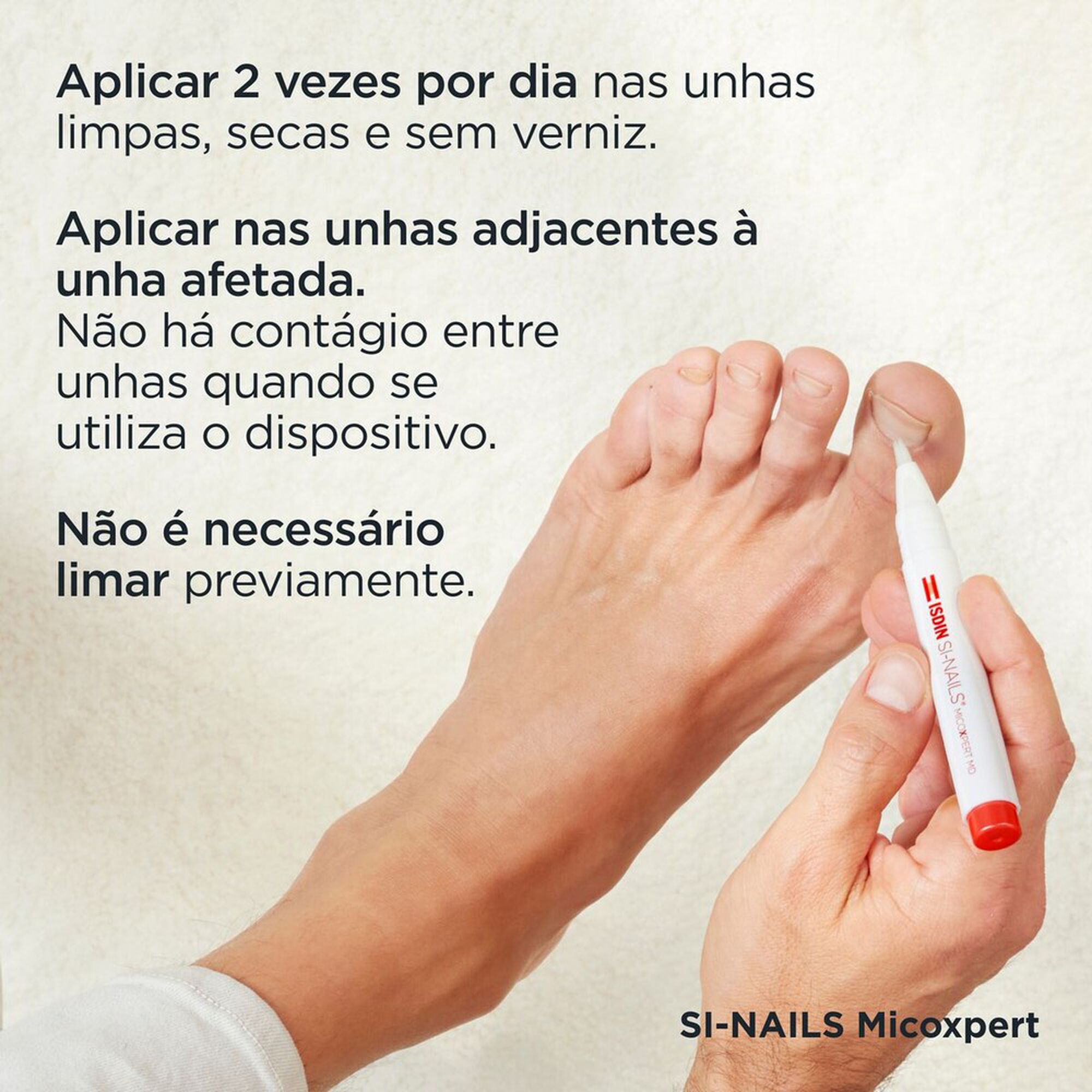 Tratamento Fungos Unhas Si-Nails MicoXpert MD
