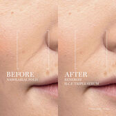 Rénergie HCF Triple Serum Wells Image 14