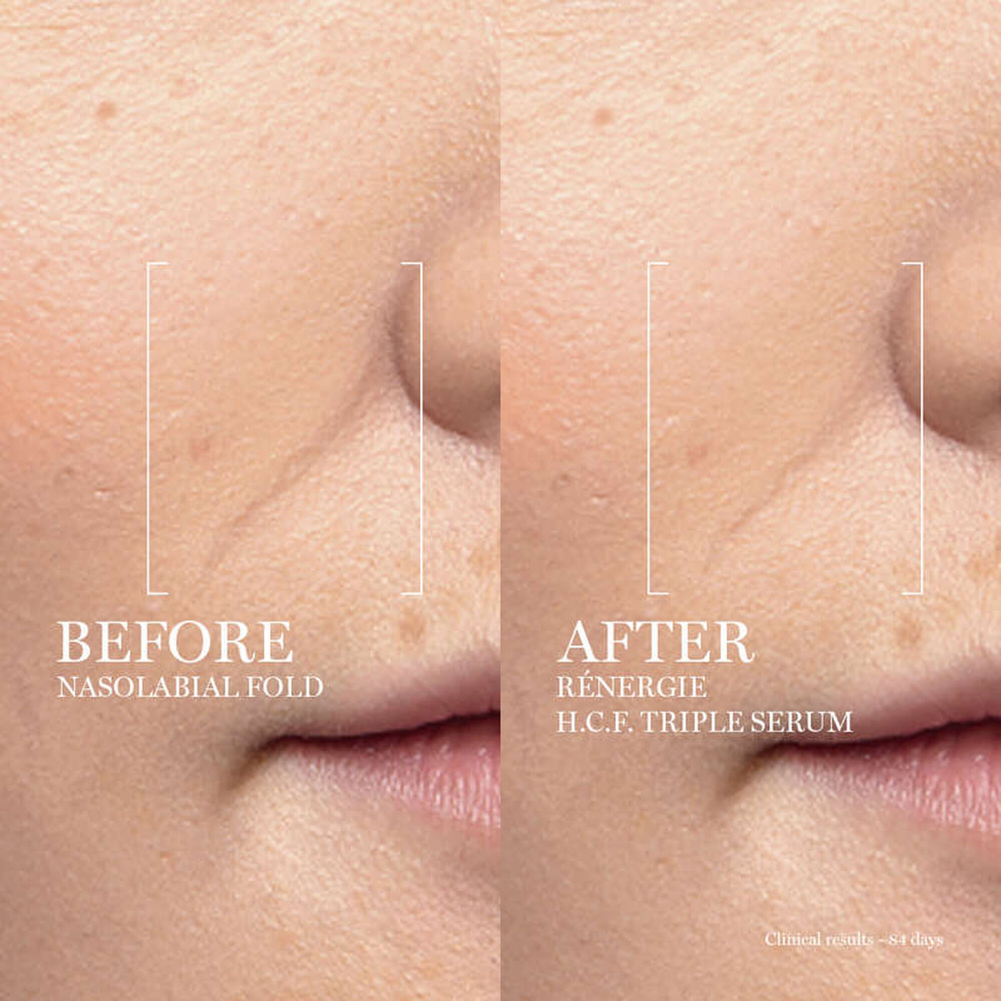 Rénergie HCF Triple Serum