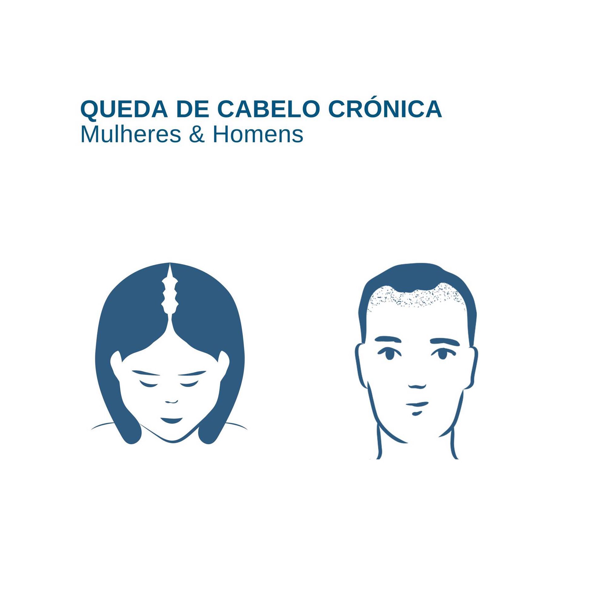 Ducray Anacaps Expert