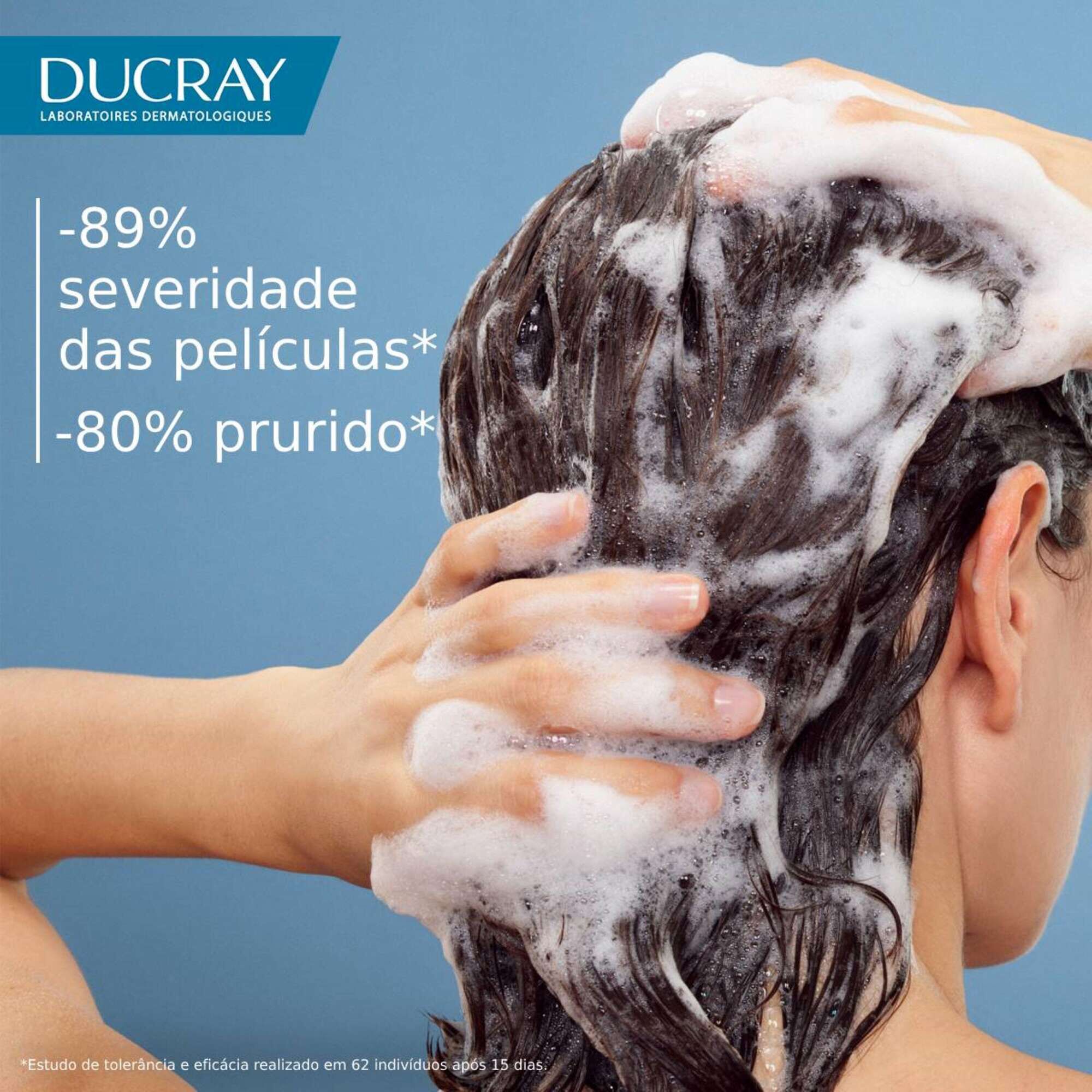 Kelual DS Treatment Shampoo