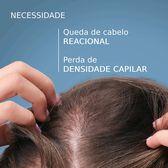 Anaphase Creastim Anti-hair Loss & Growth Wells Image 6