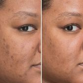 Bye Bye Dark Spots Concentrated Derma Serum Wells Image 2