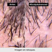 Serie Expert Scalp Advanced Pelliculaire Shampoo Wells Image 29
