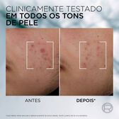 Derma Control Sérum Anti-Imperfeições Wells Image 7