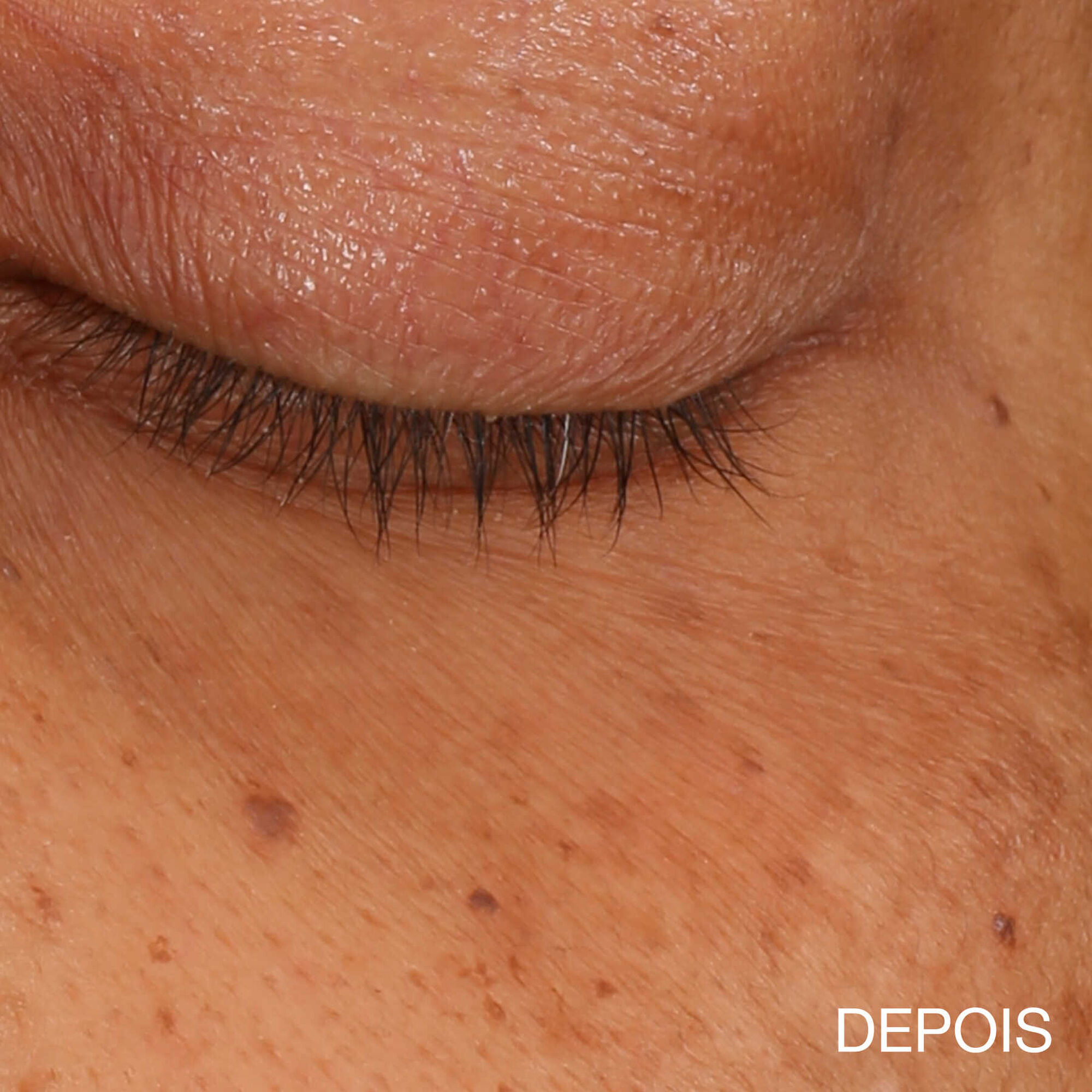 All About Eyes Brightening Serum Concentrate