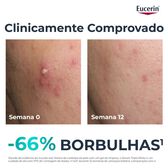 Dermo Pure Post-Acne Marks Reduction Serum Wells Image 2