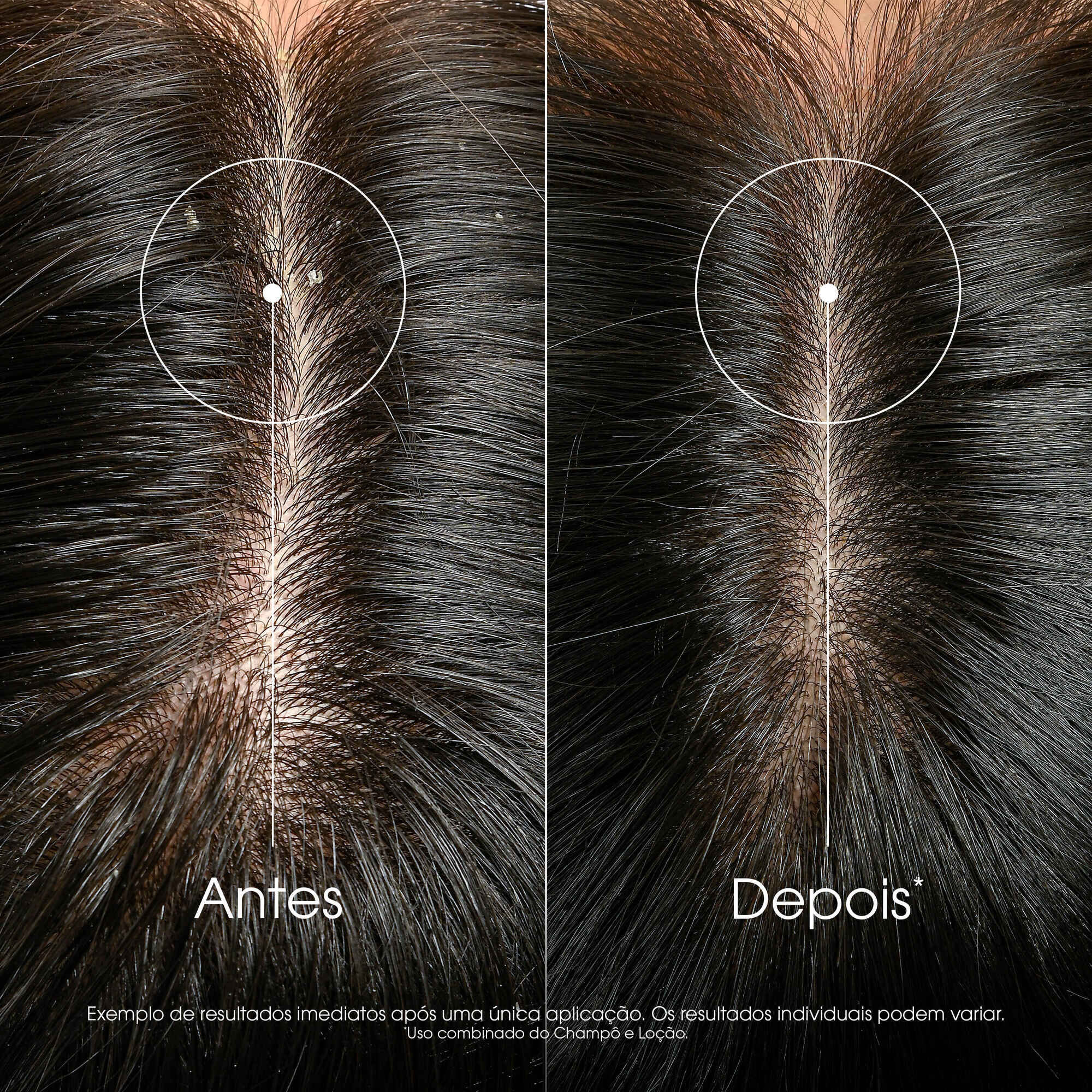 Galanga Anti-Dandruff Anti-itching Treatment