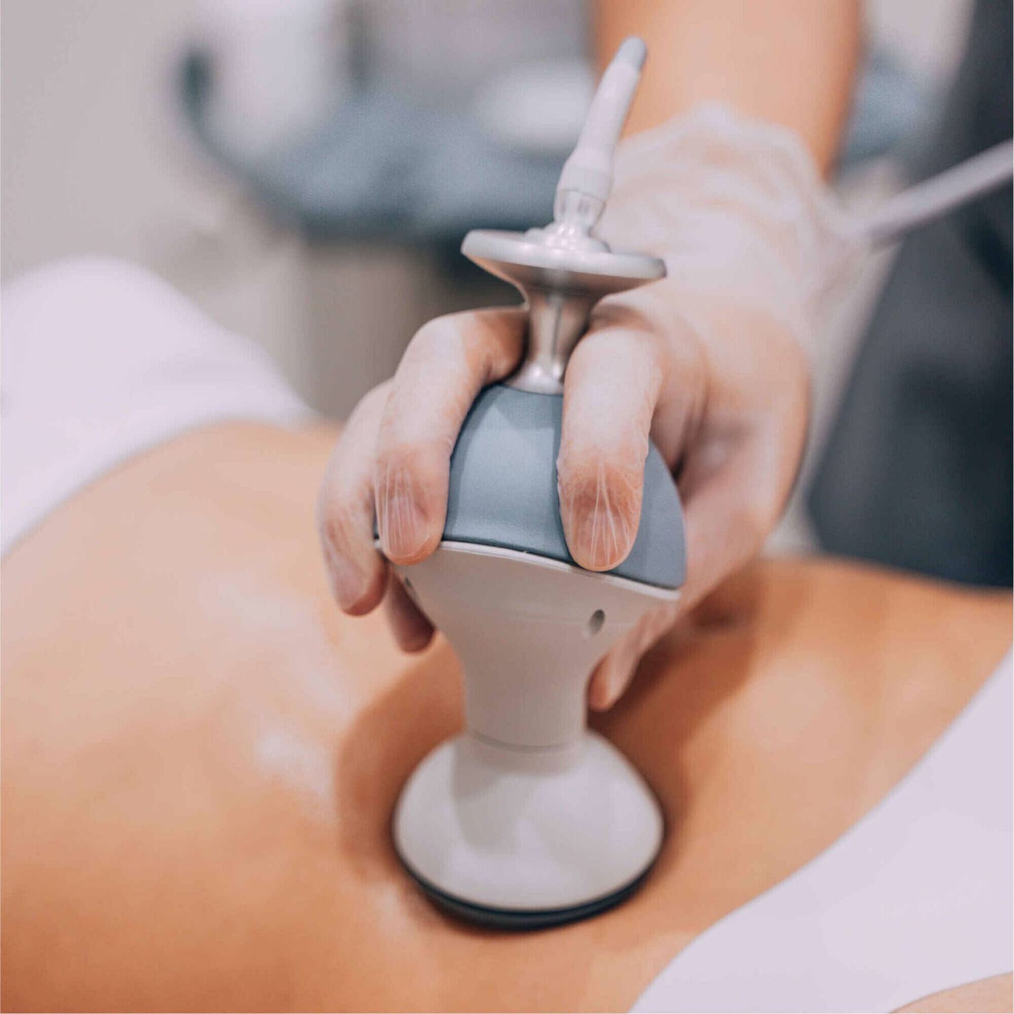 Voucher Digital Radiofrequência Corpo 