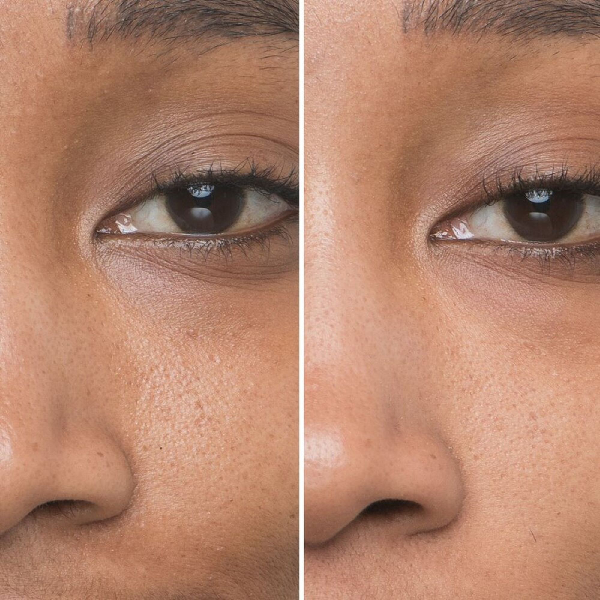 Bye Bye Pores Concentrated Derma Serum