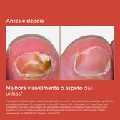 Tratamento Fungos Unhas Si-Nails MicoXpert MD Wells Image 6