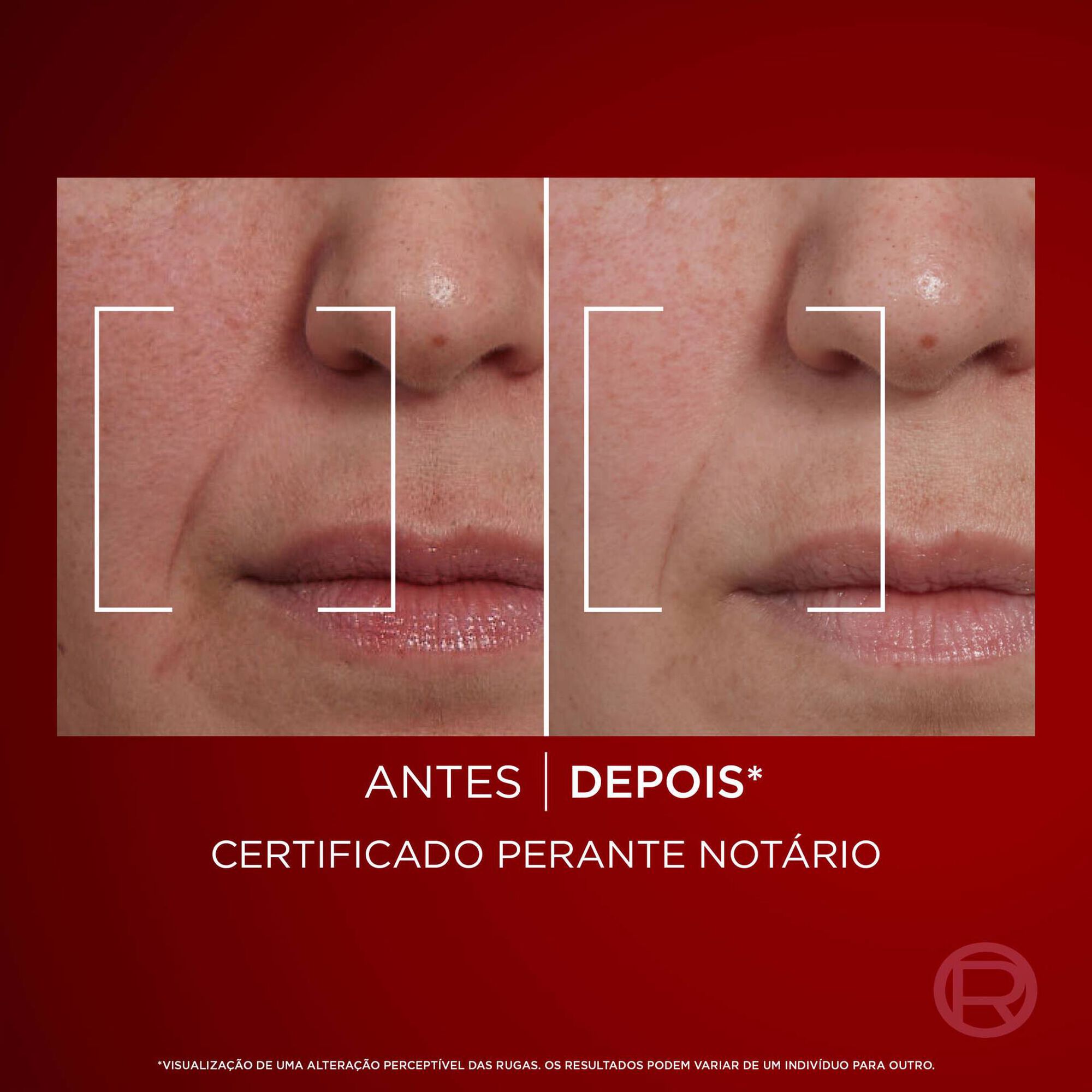 Creme de Dia Anti Rugas Revitalift Laser X3