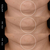Rénergie HPN 300-Peptide Cream Wells Image 3