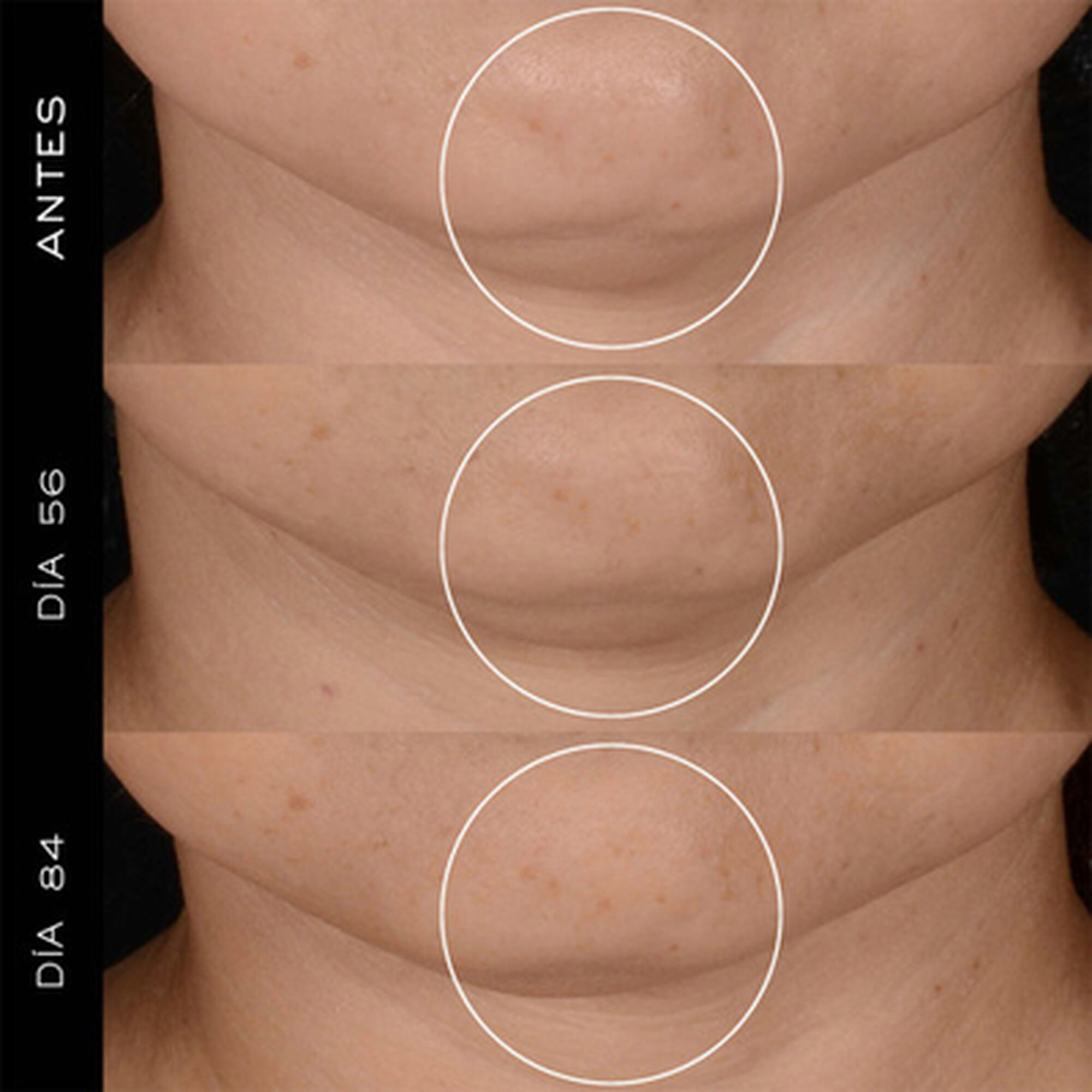 Rénergie HPN 300-Peptide Cream