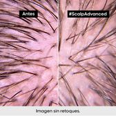 Serie Expert Scalp Advanced Inconfort Traitement Wells Image 2