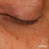 All About Eyes Brightening Serum Concentrate Wells Image 9