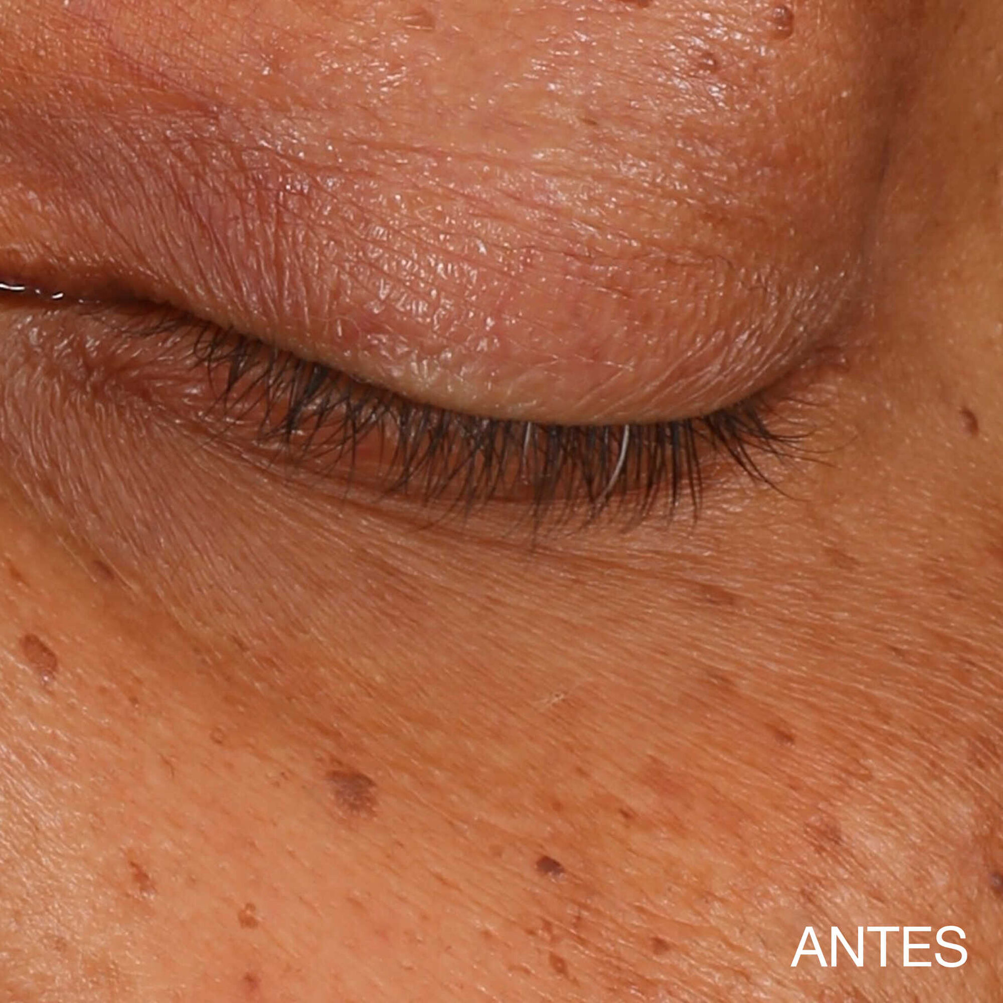 All About Eyes Brightening Serum Concentrate