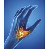 Órtese Polegar Epitact Noite Direita L Wells Image 3