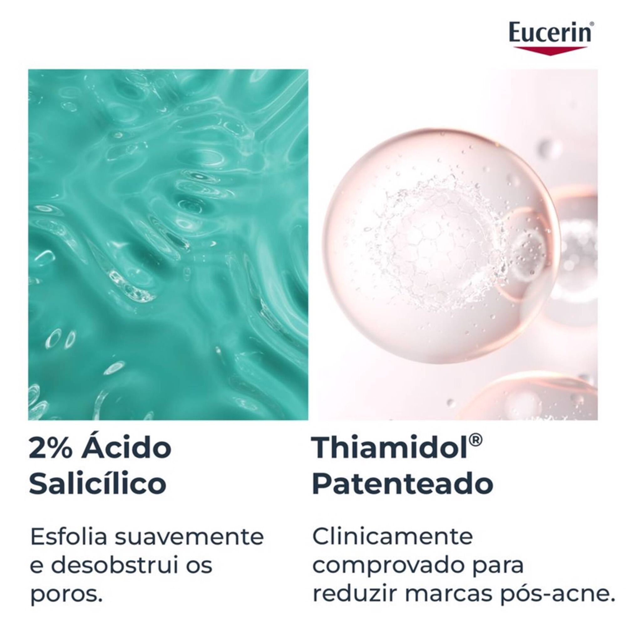 Creme de Corpo Pele Acneica DermoPure