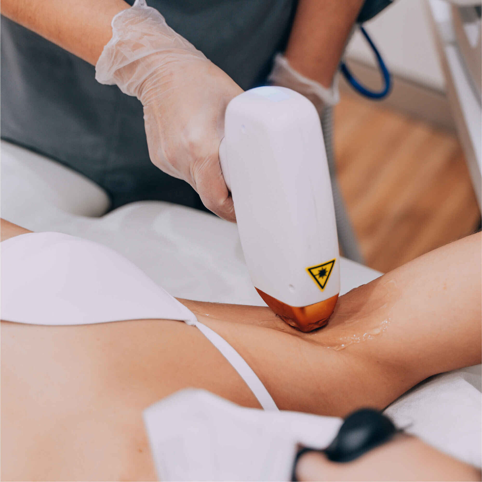 Voucher Digital Laser Axila & Virilha 