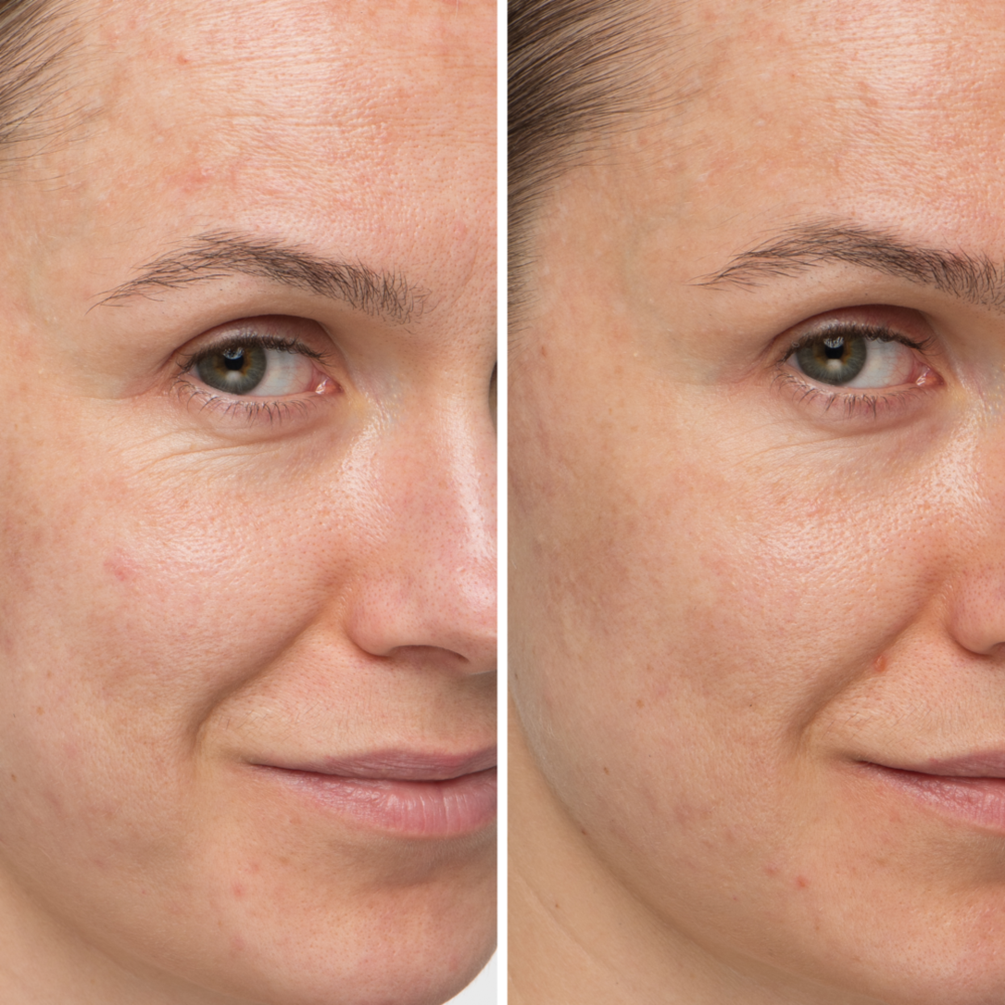 Confidence in a Cream Anti-Aging Armour