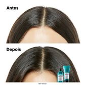 Scalp Advanced Serie Expert Shampoo Wells Image 4