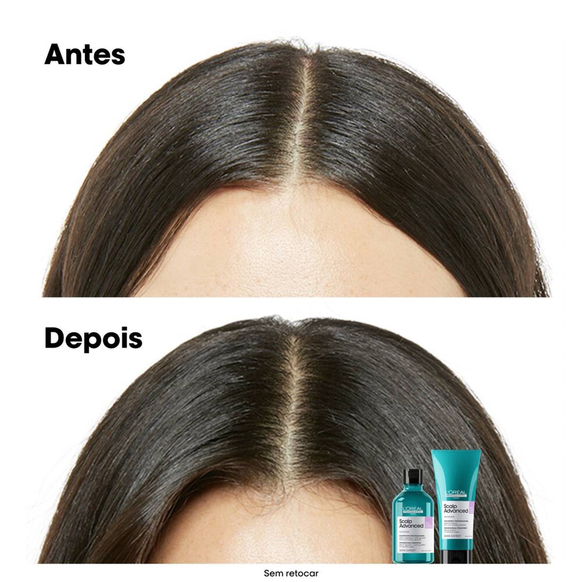 Scalp Advanced Serie Expert Shampoo