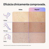 Skin I Expert S7 PL7147 Wells Image 10