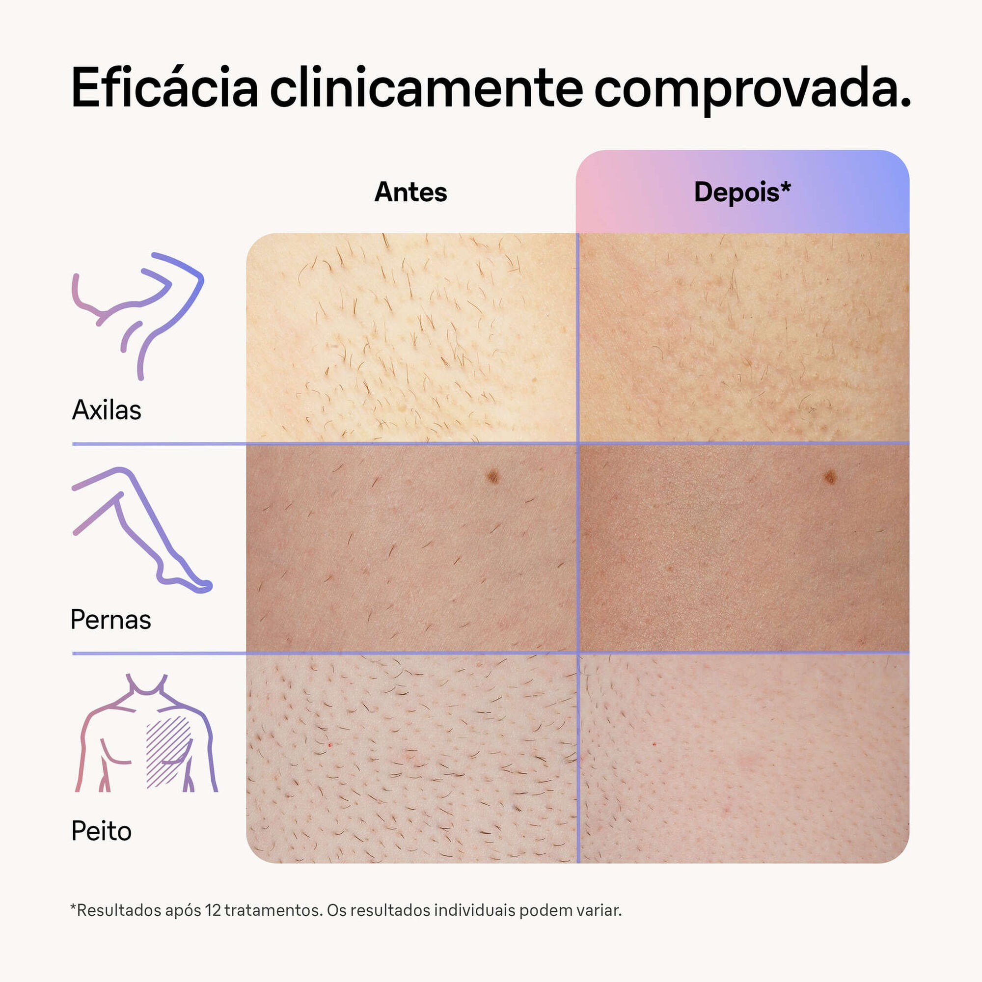 Skin I Expert S7 PL7147