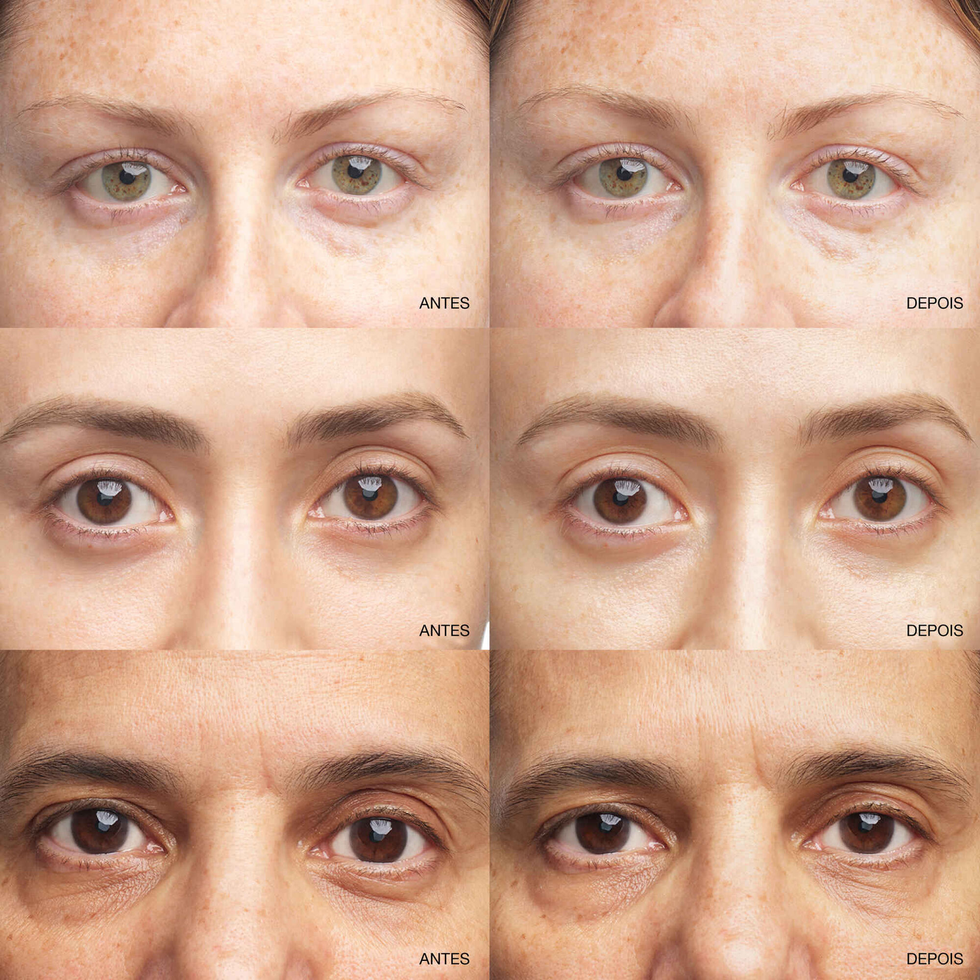 All About Eyes Brightening Serum Concentrate