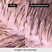 Serie Expert Scalp Advanced Pelliculaire Shampoo Wells Image 7