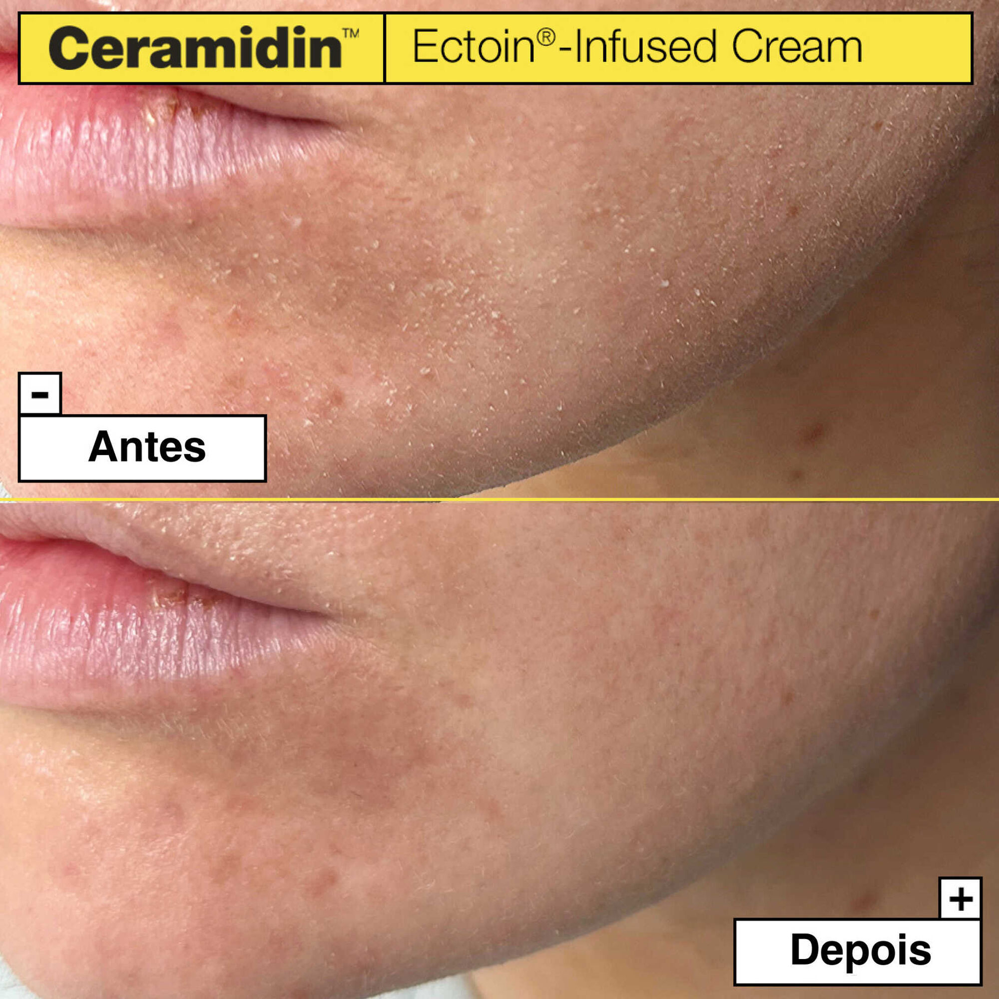 Ceramidin Ectoin-Infused Cream