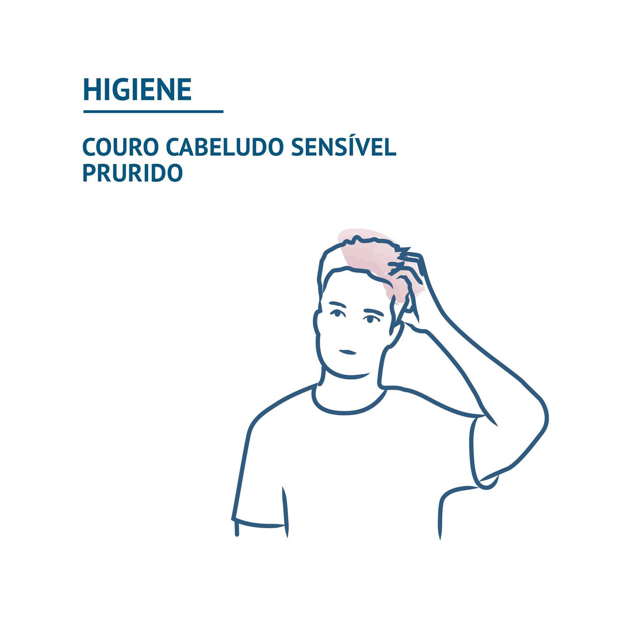 Sensinol Itching Reactive Scalps