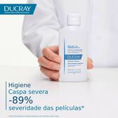 Kelual DS Treatment Shampoo Wells Image 2
