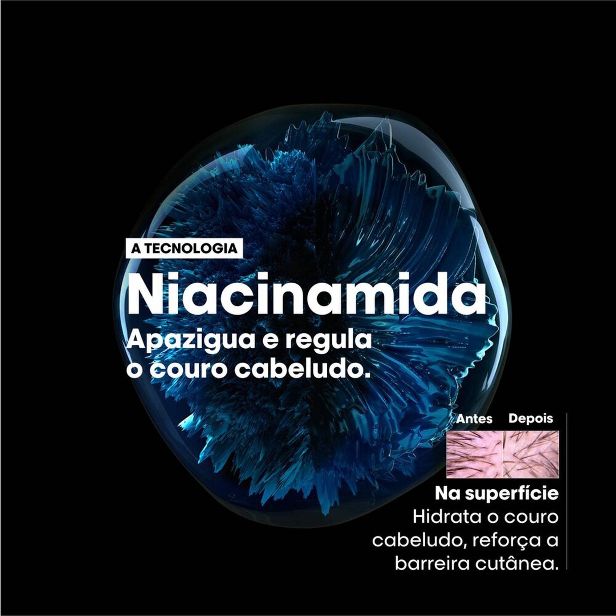 Serie Expert Scalp Advanced Inconfort Shampoo