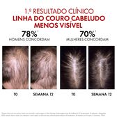 Aminexil Clinical REGEN Booster Hair Serum Wells Image 7