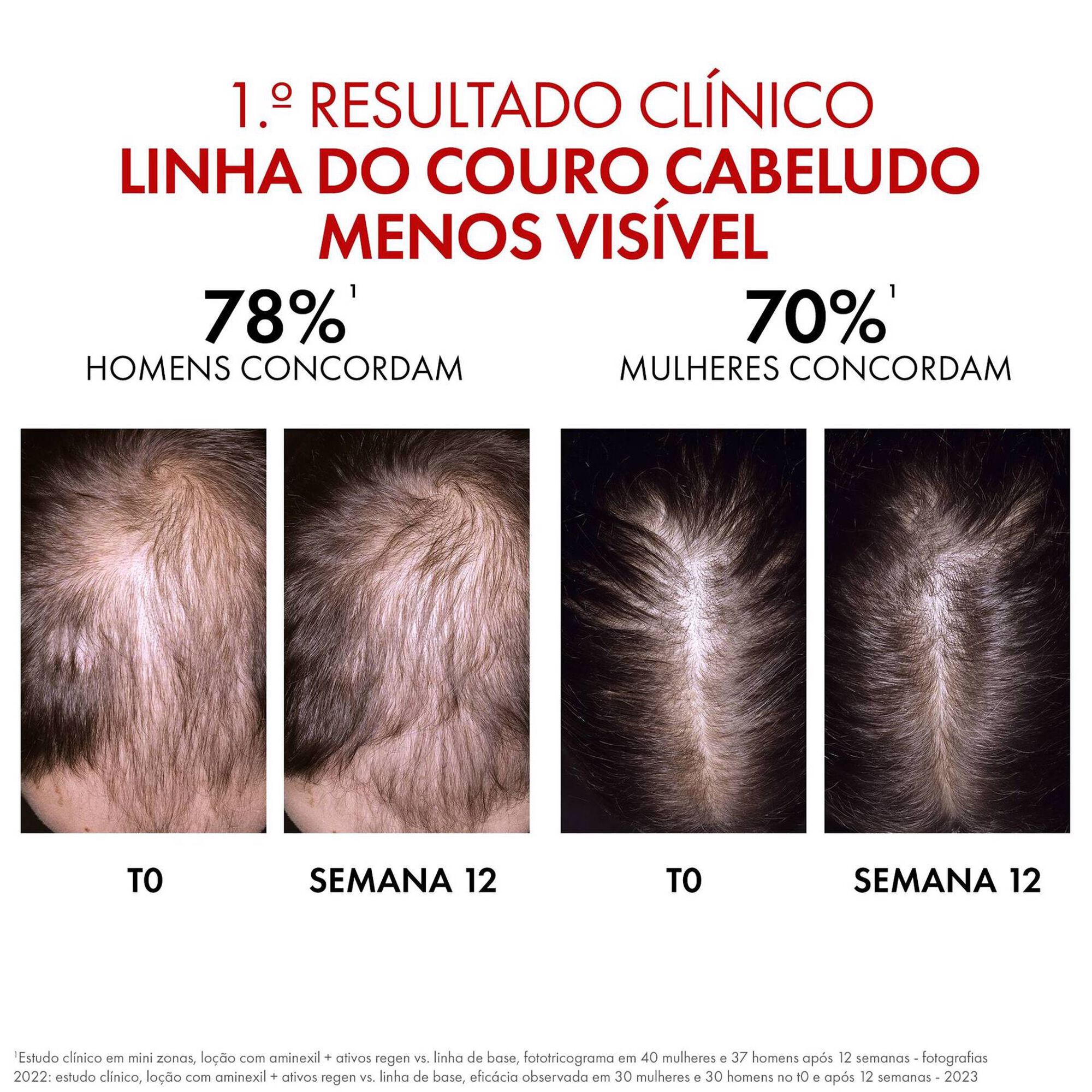 Aminexil Clinical REGEN Booster Hair Serum