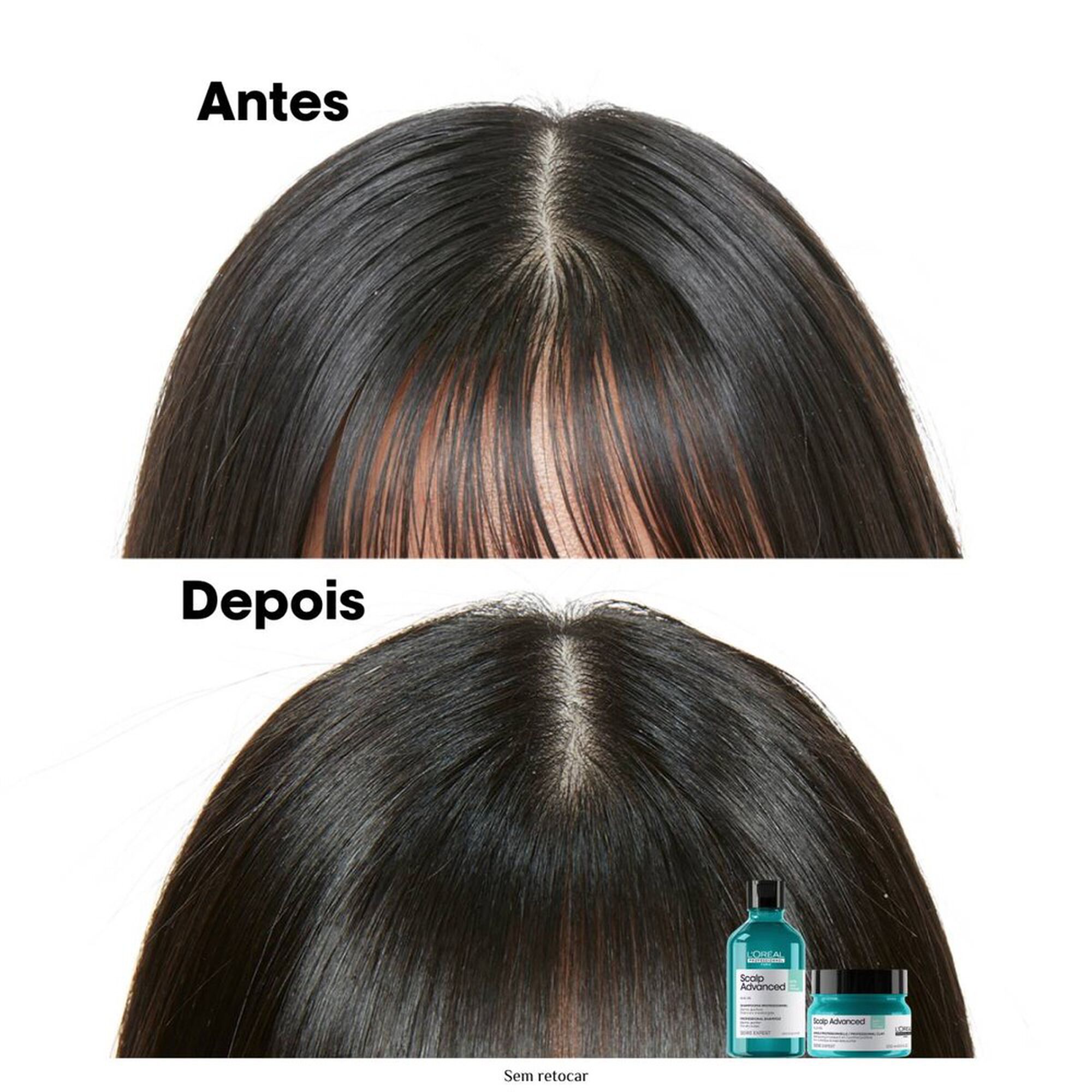 Serie Expert Scalp Advanced Anti-Gras Argile