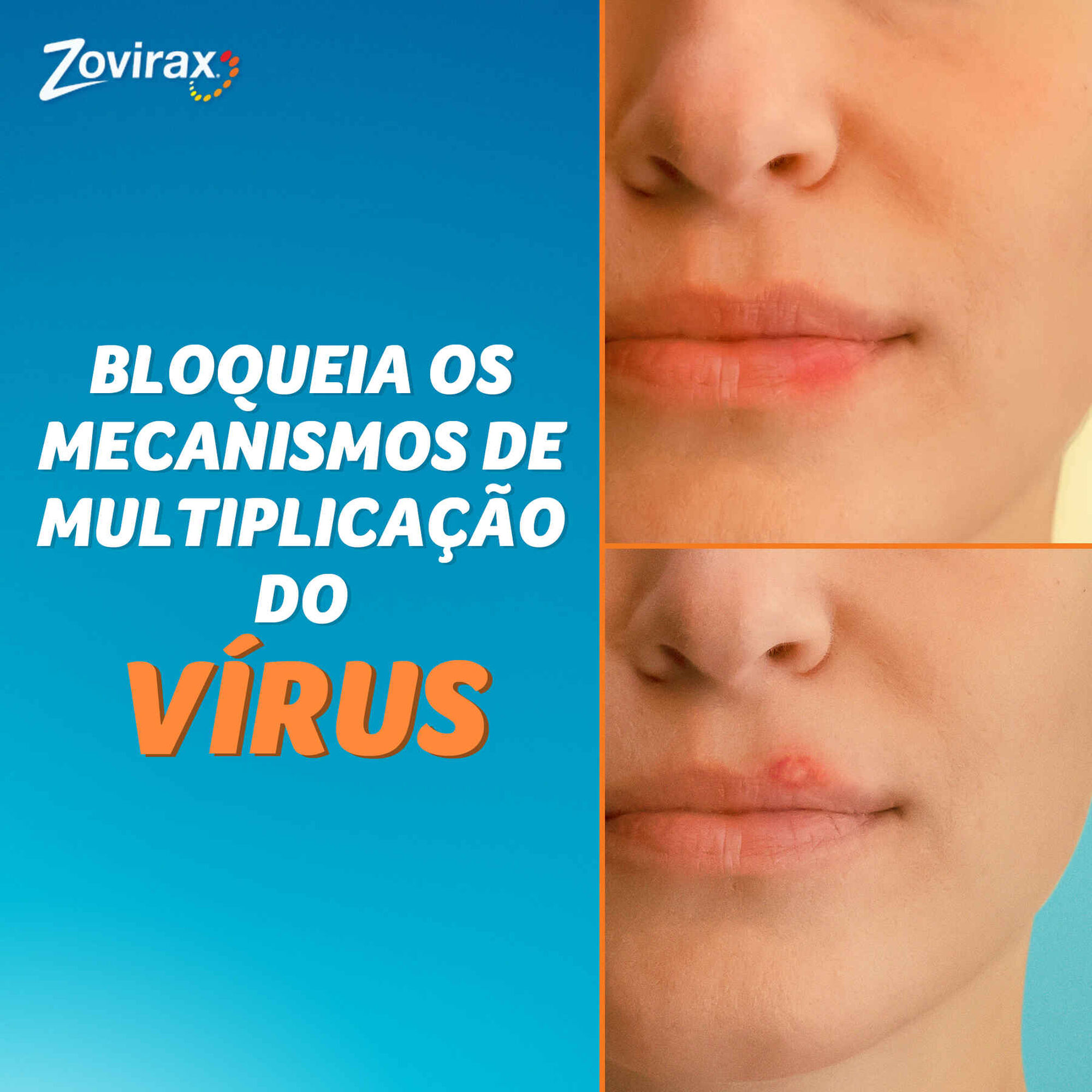 Zovirax Creme Herpes Labial Aciclovir