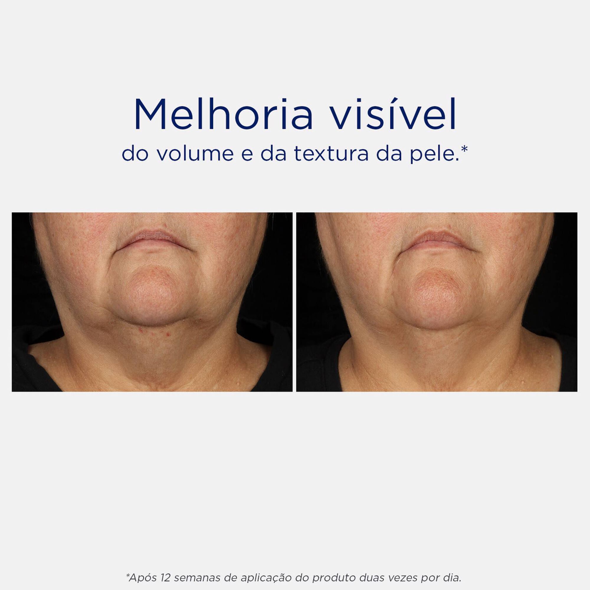Creme de pescoço  tripla firmeza Skin Active