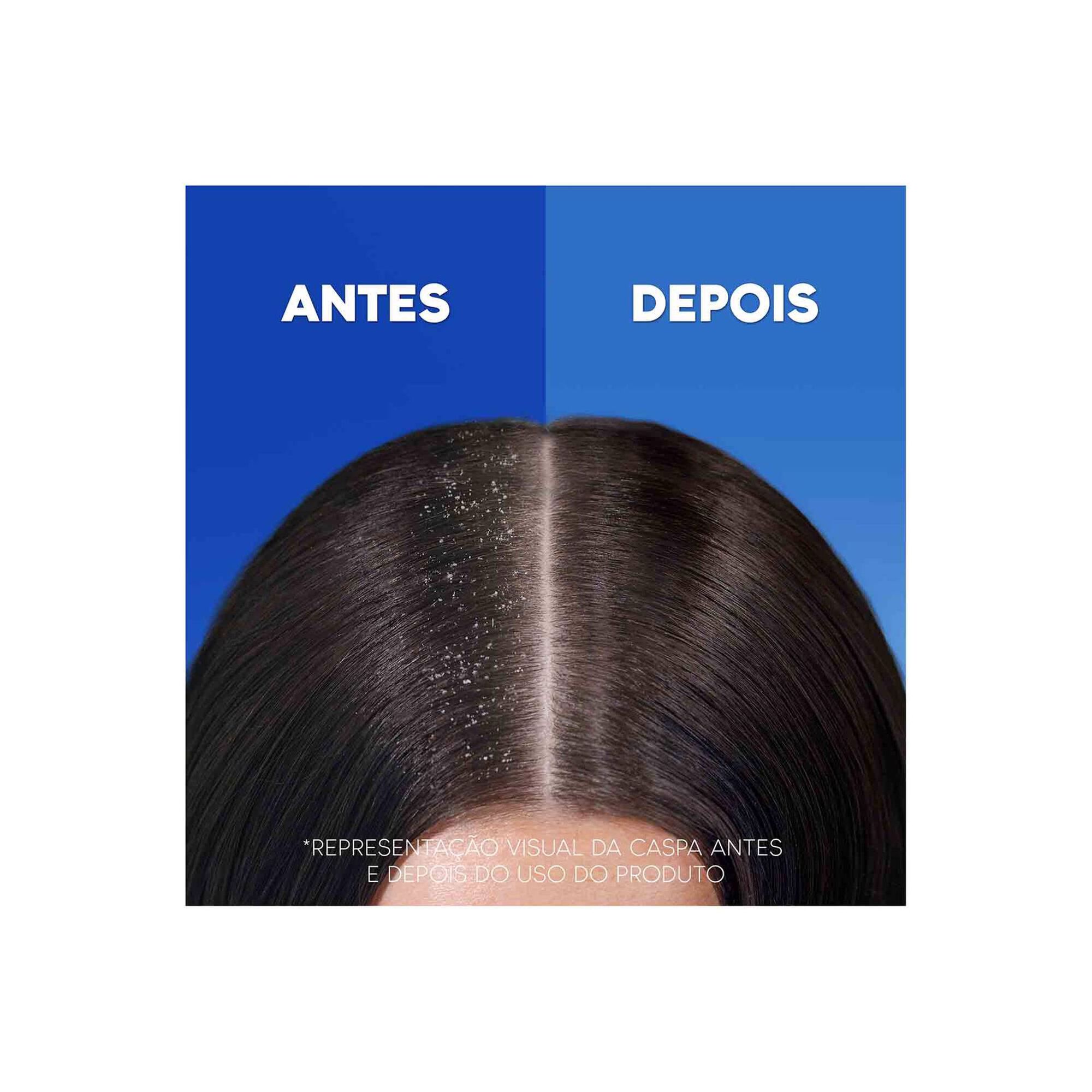 Champô Mentol Fresh Anticaspa