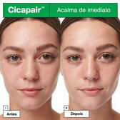 Cicapair Intensive Soothing Repair Serum Wells Image 3
