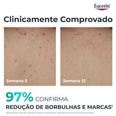 Creme de Corpo Pele Acneica DermoPure Wells Image 2