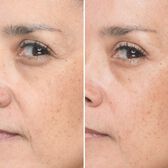 Bye Bye Lines Sérum Concentrated Derma Serum Wells Image 2